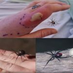What to do if you get bit.ten by a black widow spider: A complete guide