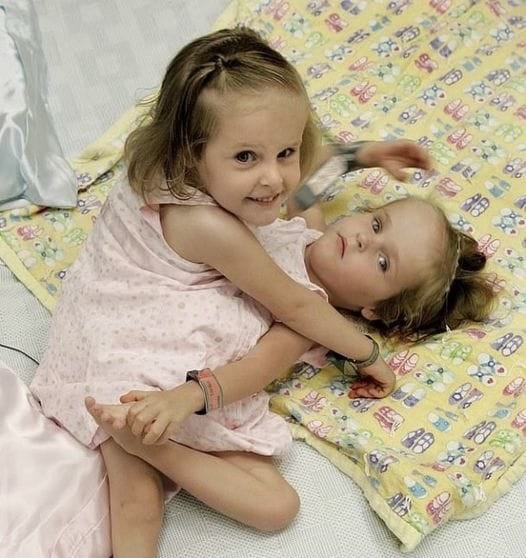 “Unbelievable story These girls were born as siamese twins, but were successfully separated at the age of four in 2006.Now they are already 18.The sisters live independent lives, attend school, like drawing, and inspire others through social media. Have a look at the photos of the girls in the comments below”