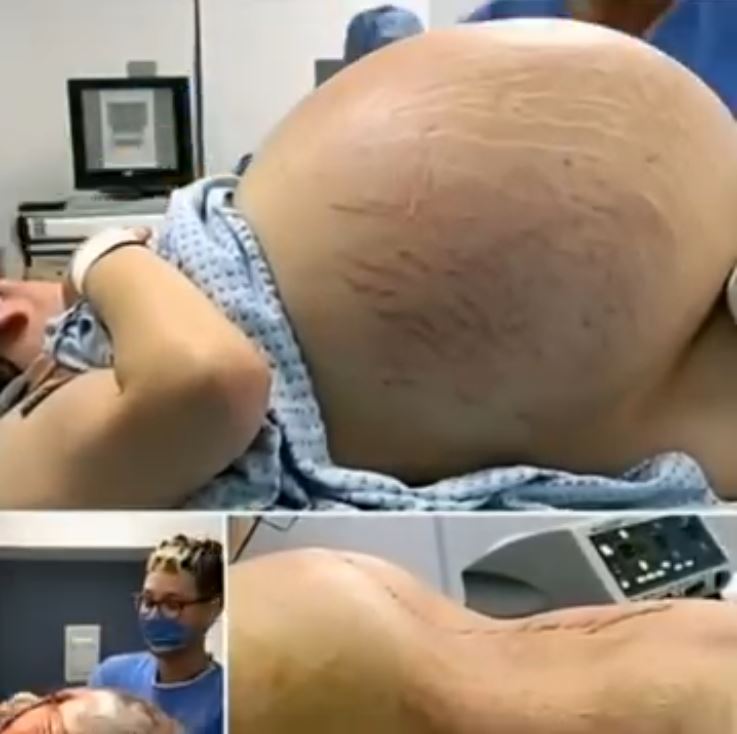 She went into labor, and you won’t believe what they took out of her wo…