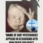 “God’s Hand” in Ultrasound Photo Brings Comfort to Grieving Mom