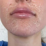 Say Goodbye to Dry Skin with These Expert Tips