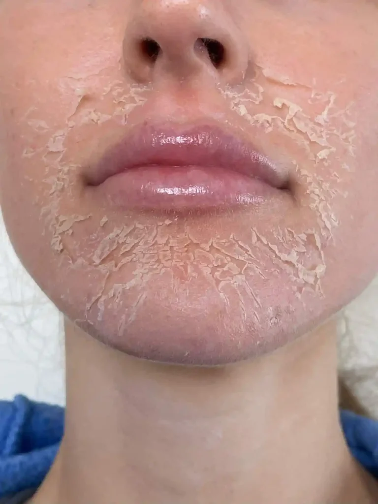 Say Goodbye to Dry Skin with These Expert Tips