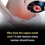 What Every Woman Should Know About Vaginal Odor