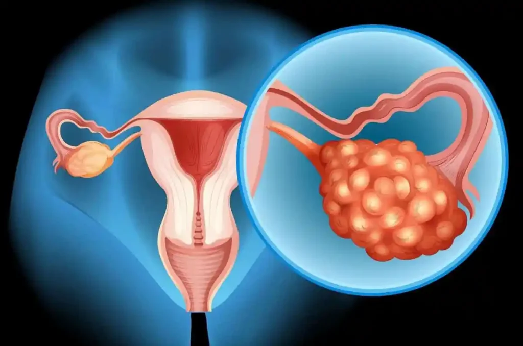 The Hidden Connection Between Two Deadly Cancers Every Woman Should Know