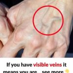 Should You Worry About Suddenly Visible Veins?