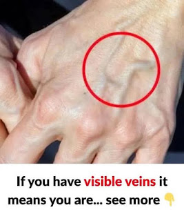 Should You Worry About Suddenly Visible Veins?