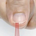 What Vertical Ridges on Your Nails After 40 Could Mean