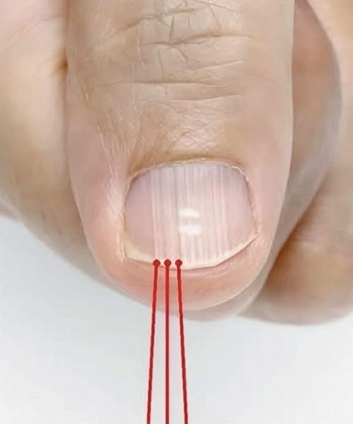What Vertical Ridges on Your Nails After 40 Could Mean