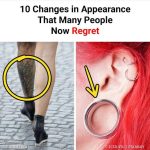 10 Body Modifications That Didn’t Quite Work Out: Regretting Beauty Trends