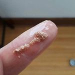 The Truth About Those Mysterious White Spots in Your Eggs