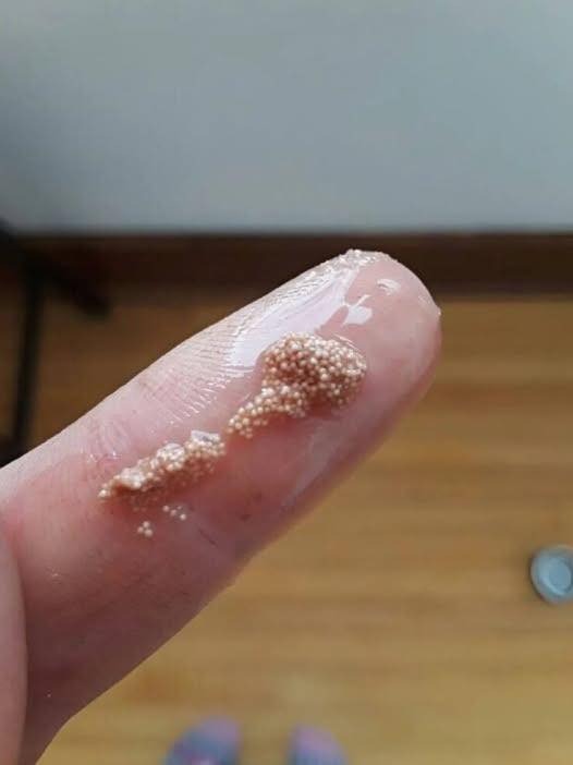 The Truth About Those Mysterious White Spots in Your Eggs