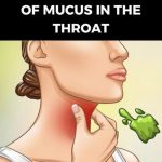 Recognising Excess Mucus: Reasons and Solutions