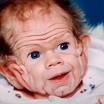 In 1993, This Boy Was Born With Enough Skin For A Five-Year-Old. But Wait Till You See Him Today