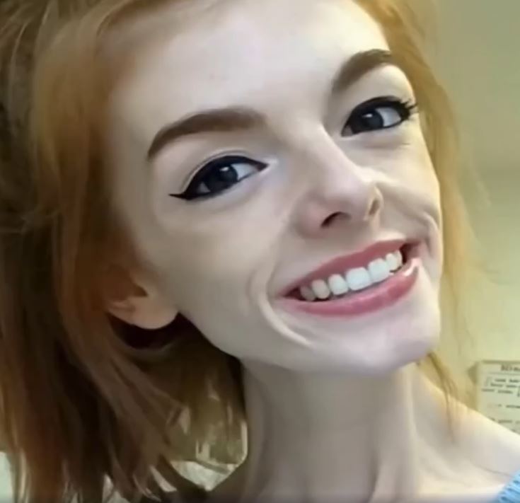 A Woman Was Eating Only One Piece Of Bread A Day, But Wait Till You See Her Now… WOW