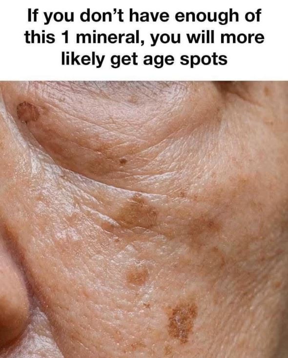 Erase Age Spots Naturally After 60 With This Little-Known Mineral