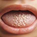 Warning: What Could Happen If You Sleep With the…