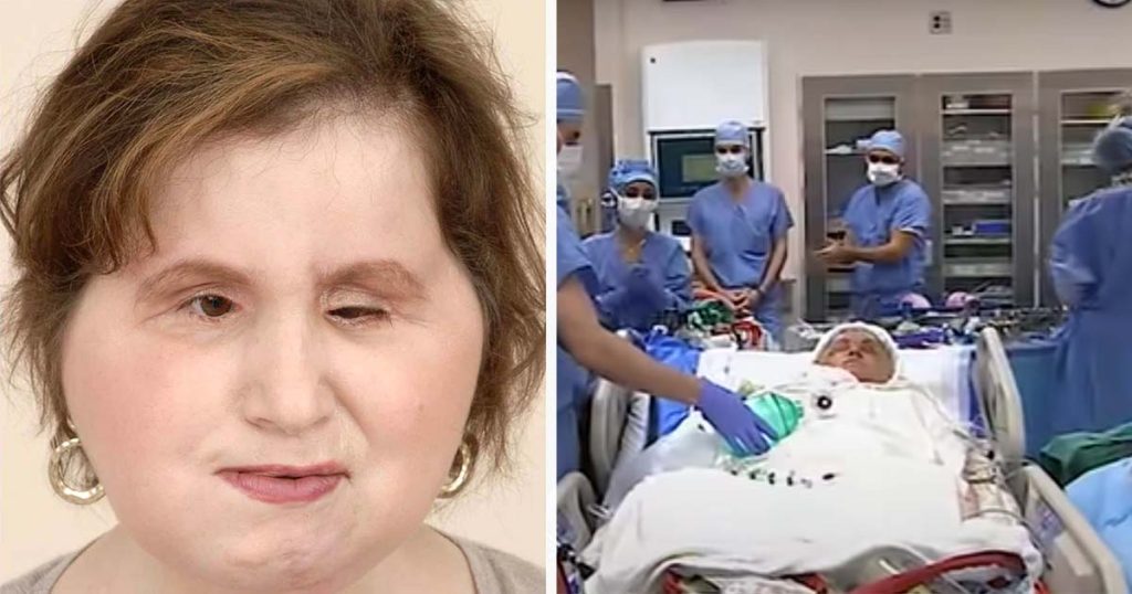 Katie Stubblefield’s Inspiring Story: The Youngest Face Transplant Recipient