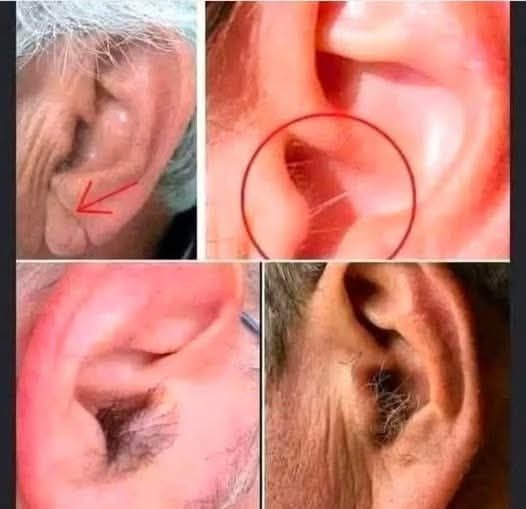 Why Do We Grow Hair in Our Ears as We Age?