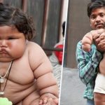 This baby weighed 20 kilograms at just eight months old, making her the heaviest child on the planet. Look at what she looks like today…