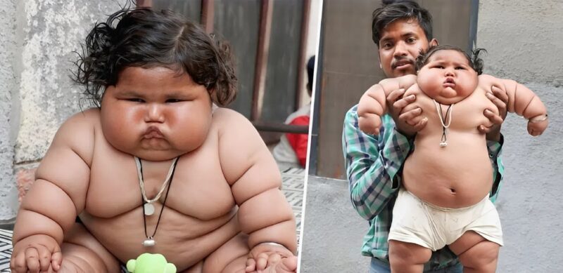 This baby weighed 20 kilograms at just eight months old, making her the heaviest child on the planet. Look at what she looks like today…