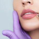 Plastic Surgeon Warns About Long-Term Damage Fillers Can Cause
