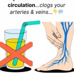 Top 5 Drinks That Harm Circulation and Clog Arteries
