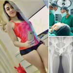 Dangerous Experiment Lands Young Woman in Hospital, Experts Issue Warnings