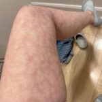 The Unseen Consequences of Intimacy