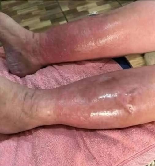 Important Health Warning Signs Your Feet Can Reveal