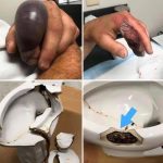 In several regions, while using their toilets, people were attacked