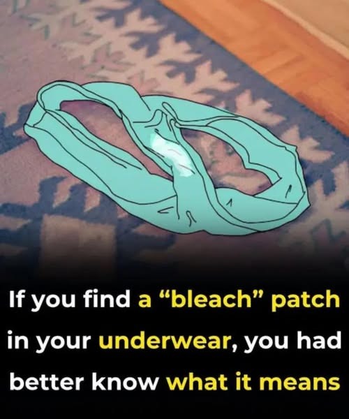 Understanding Vaginal Discharge and Bleach-Like Stains