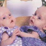 Miracle Twins Kendra and Maliyah Herrin Now Lead Independent Lives After Separation