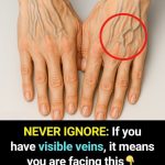 Why Are Young People’s Hand Veins So Visible? Here’s What Experts Say