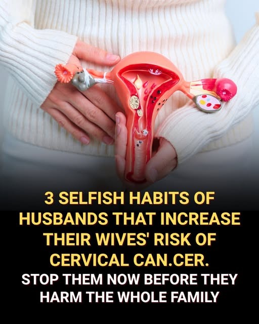 Husbands’ Habits That Raise the Risk of Cervical Cancer for Their Wives