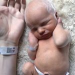 A Tale of Resilience: How an Albino Family Found Joy