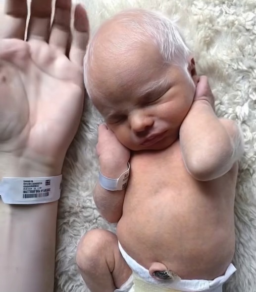 A Tale of Resilience: How an Albino Family Found Joy