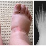 Listen to Your Body: What Swollen Feet and Hands Might Be Trying to Tell You