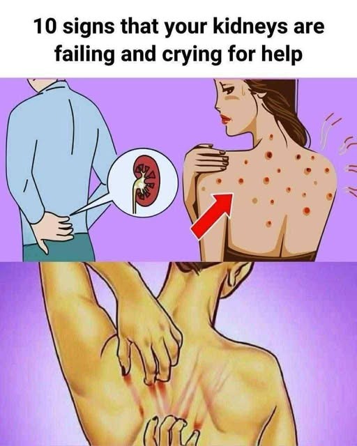 Listening to Your Body’s Signals: Ten Clues Your Kidneys Might Need Help