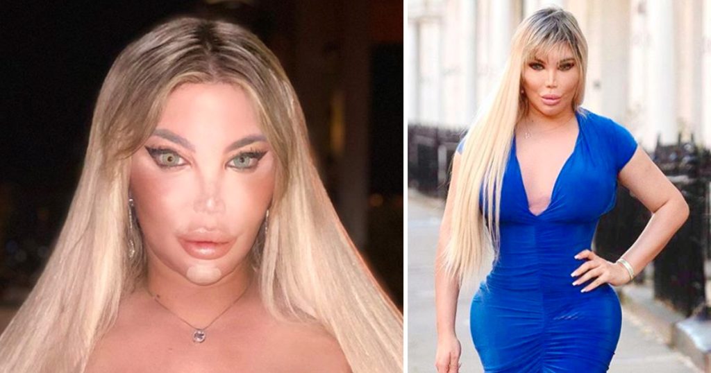 A Medical Odyssey: The High-Stakes Surgical Journey of Jessica Alves