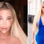 A Medical Odyssey: The High-Stakes Surgical Journey of Jessica Alves